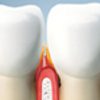 Gum Disease Small